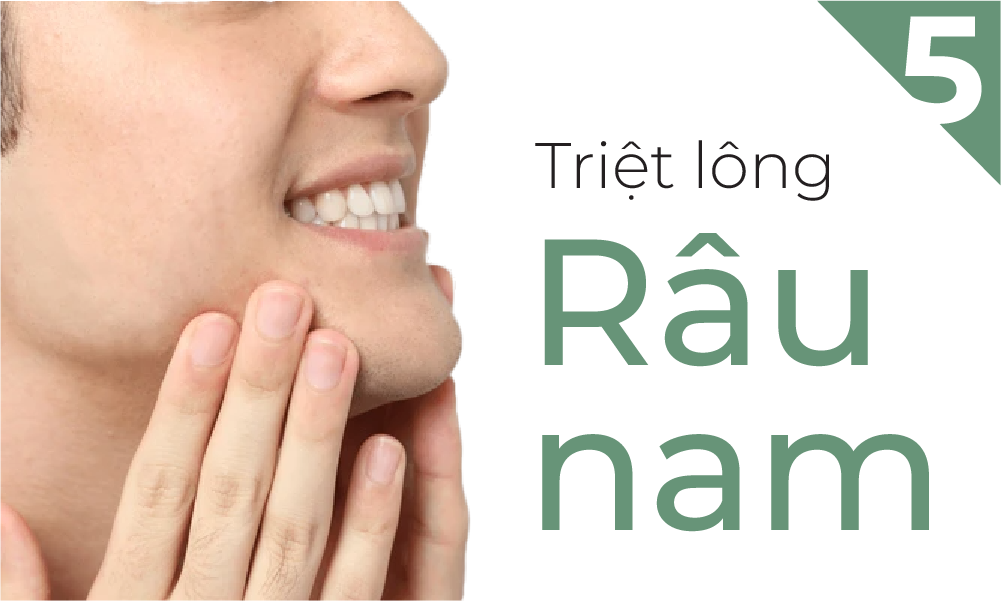 Thẻ triệt râu quai nón nam 5 buổi